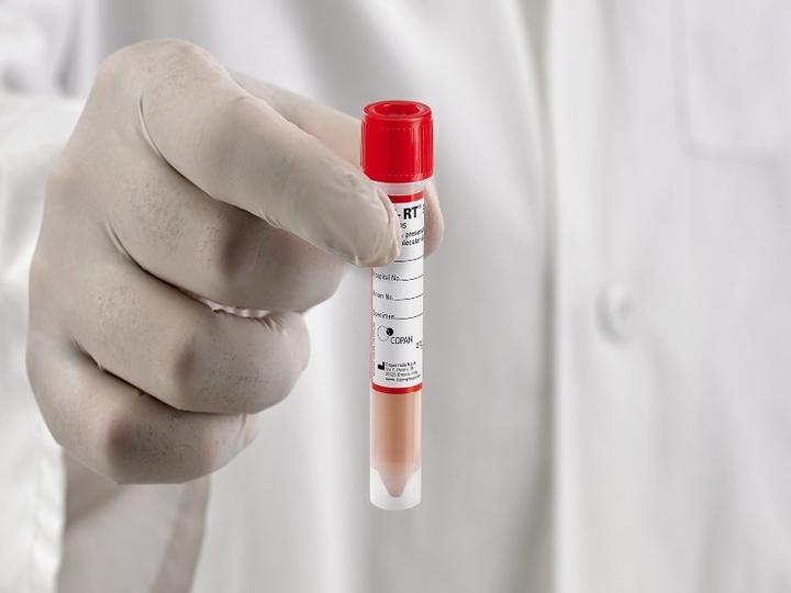 Trans Isolate Medium Universal Transport Medium with Transport Swab - Sterilab – Sterilab ...